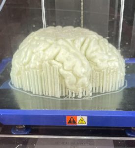 Printing a glow-in-the-dark brain with supports